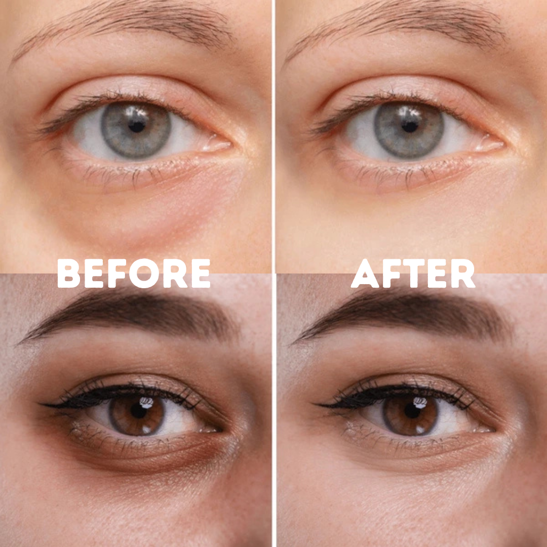 Élo Eye Serum